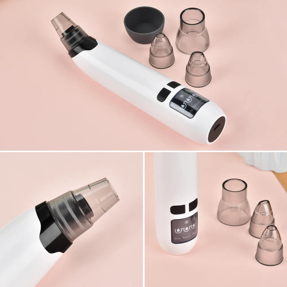 Blackhead Vacuume Remover