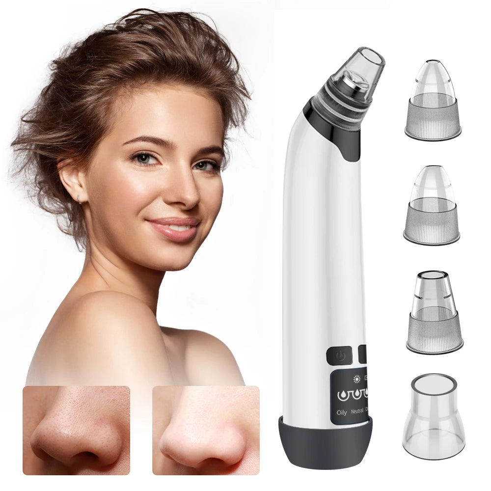 Blackhead Vacuume Remover