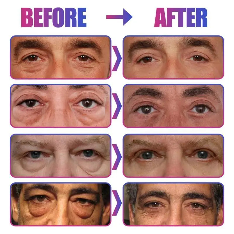 Collagen Eye Mask