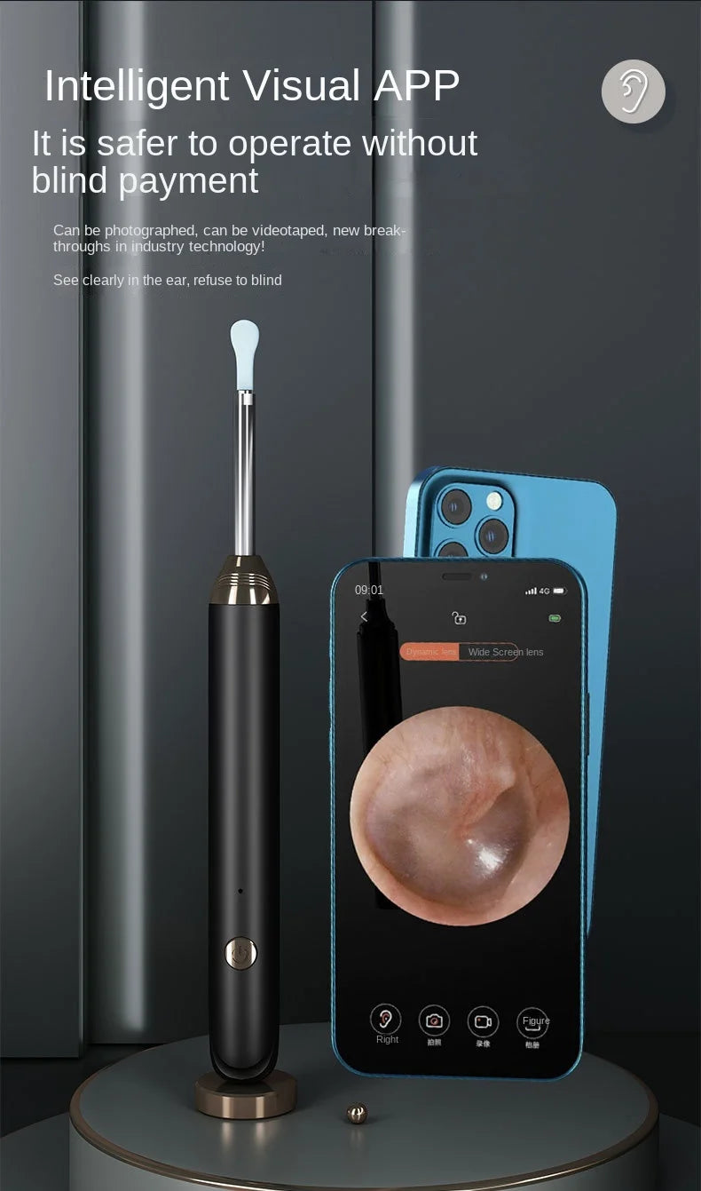 Intelligent Visual Ear Cleaner