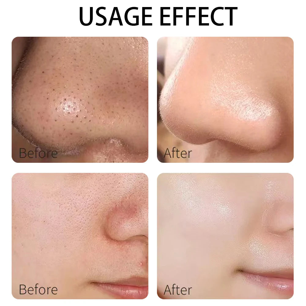 Clay mask Variety