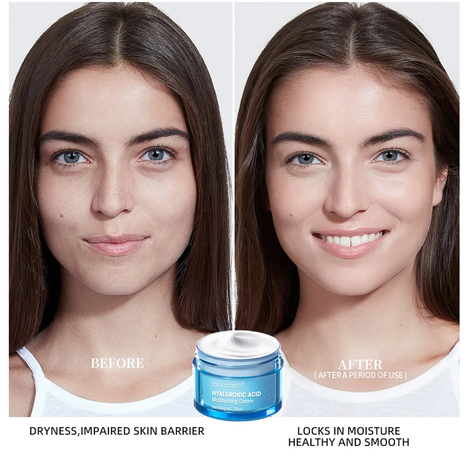 Hyaluronic Acid Gel Cream