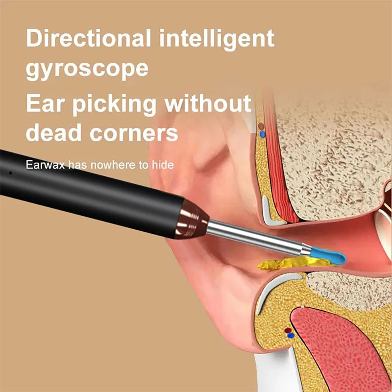 Intelligent Visual Ear Cleaner