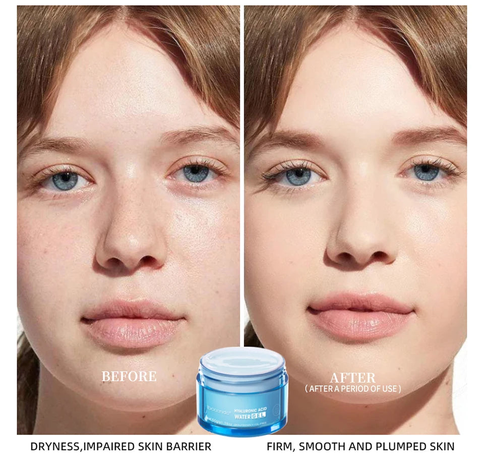Hyaluronic Acid Gel Cream